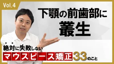 下顎の前歯部に叢生がある場合　絶対に失敗しないマウスピース矯正33のこと