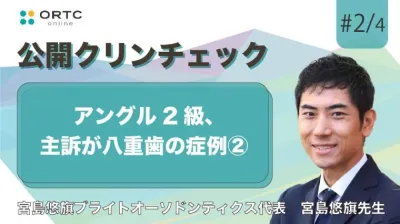 アングル2級、主訴が八重歯の症例