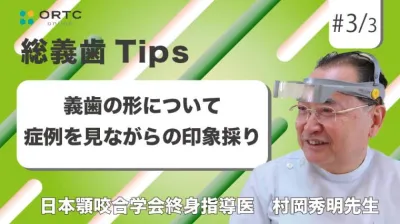 義歯の形について_症例を見ながらのコピーデンチャーの改造