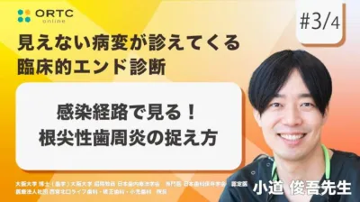 感染経路で見る！根尖性歯周炎の捉え方