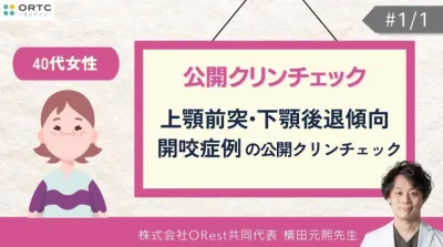 40代女性_上顎前突・下顎後退傾向・開咬症例の公開クリンチェック