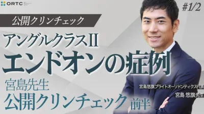 アングルクラス?_エンドオンの症例_宮島先生公開クリンチェック前半