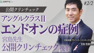 アングルクラスⅡ_エンドオンの症例_宮島先生公開クリンチェック後半