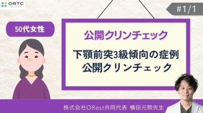 50代女性_下顎前突3級傾向の症例_公開クリンチェック