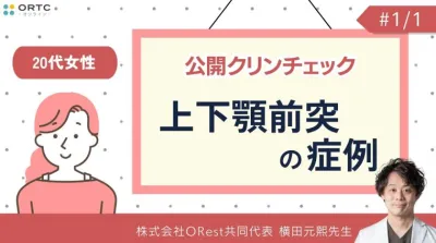 公開クリンチェック_20代女性・上下顎前突の症例