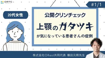 公開クリンチェック_20代女性・上顎のガタツキが気になっている患者さんの症例