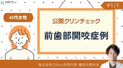 公開クリンチェック_40代女性の前歯部開咬症例