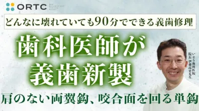 歯科医師が1本義歯新製 （肩のない両翼鈎、咬合面を回る単鈎）