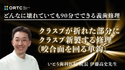 クラスプが折れた部分にクラスプ新製する修理（咬合面を回る単鈎）
