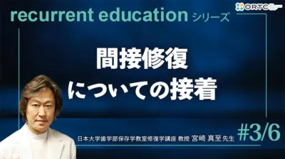 間接修復についての接着