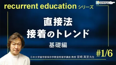 直接法　接着のトレンド　基礎編