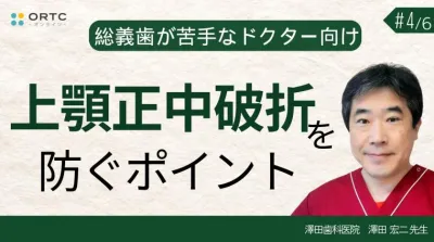 上顎正中破折を防ぐポイント