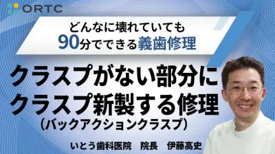 クラスプがない部分にクラスプ新製する修理（バックアクションクラスプ）