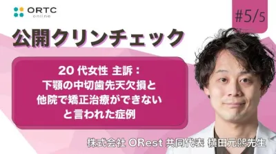 20代女性、主訴：下顎の中切歯先天欠損と他院で矯正治療ができないと言われた症例