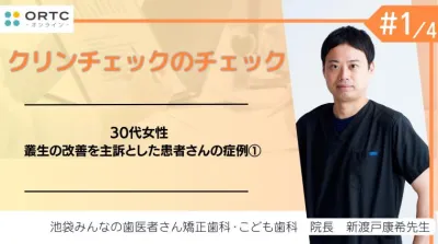 30代女性 叢生の改善を主訴とした患者さんの症例1