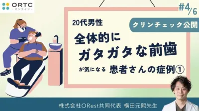 20代男性,全体的にガタガタな前歯が気になる1