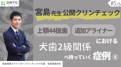 宮島先生公開クリンチェック 上顎44抜歯、追加アライナーにおける犬歯2級関係へ持っていく症例5