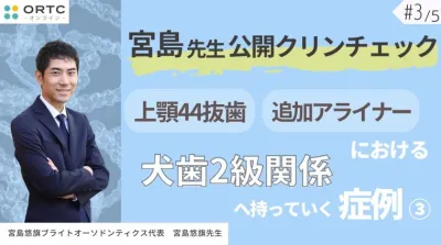 宮島先生公開クリンチェック 上顎44抜歯、追加アライナーにおける犬歯2級関係へ持っていく症例3