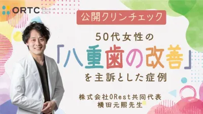 公開クリンチェック_50代女性の八重歯の改善を主訴とした症例