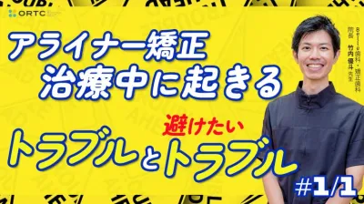 アライナー矯正治療中に起きるトラブルと避けたいトラブル