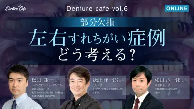 【部分欠損】左右すれちがい症例をどう考える？｜Denture Cafe vol.6